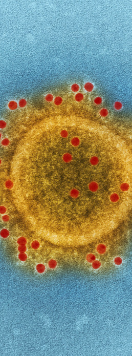 this highly magnified, digitally colorized transmission electron microscopic (TEM) image highlights the particle envelope of a single, spherical shaped, Middle East respiratory syndrome coronavirus (MERS-CoV) virion