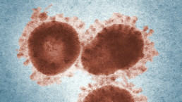 Three avian infectious bronchitis virus (IBV) virions