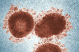Three avian infectious bronchitis virus (IBV) virions